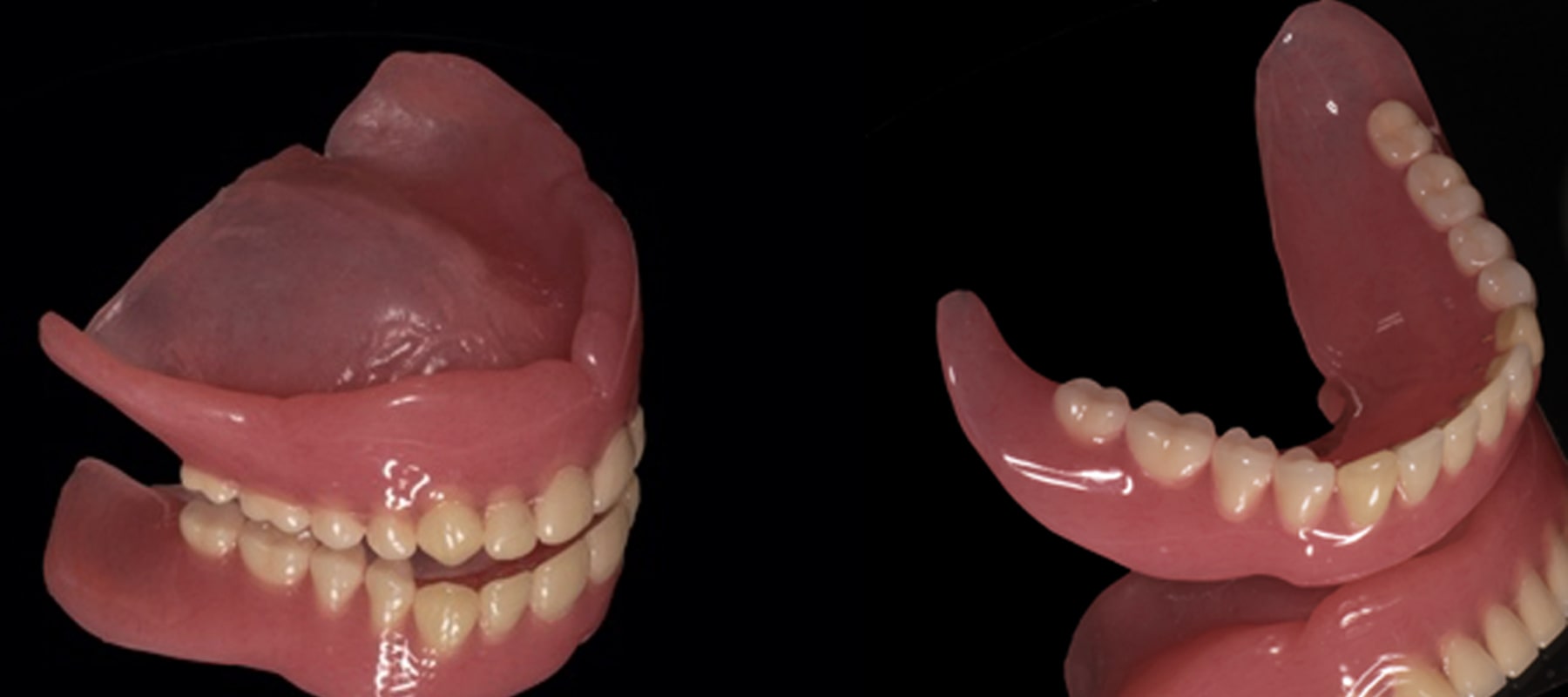 義歯の種類