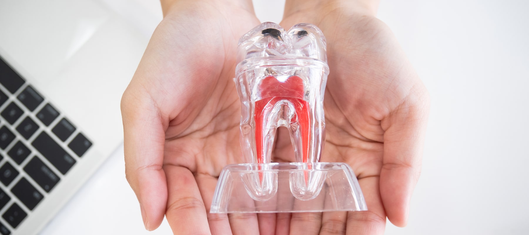予防歯科の重要性