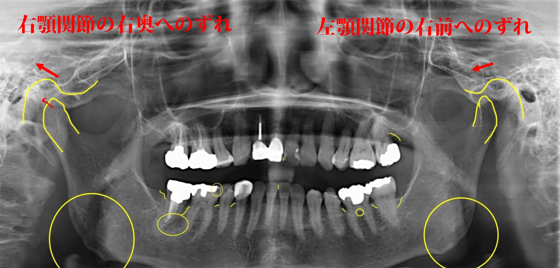 歯列・歯並びの問題