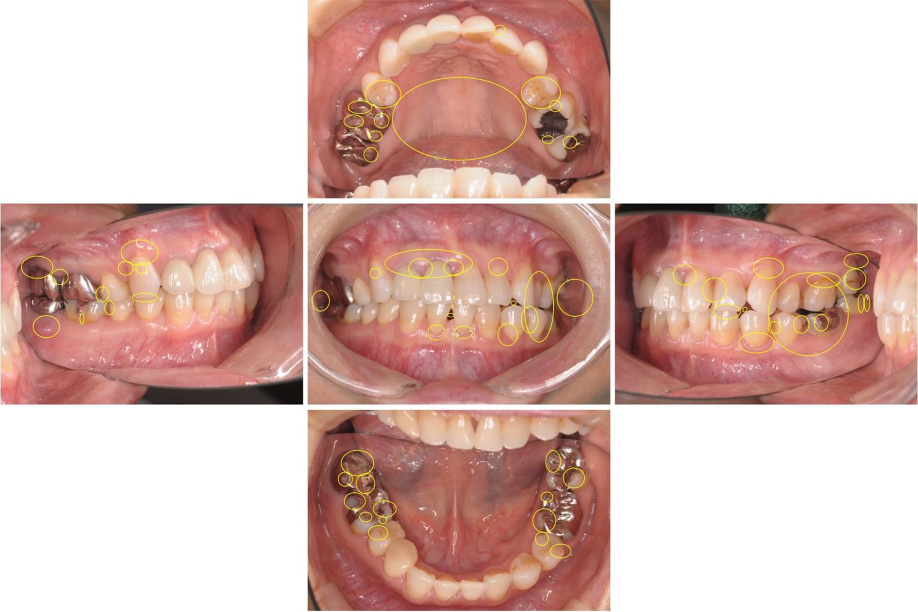 歯周病•むし歯の問題